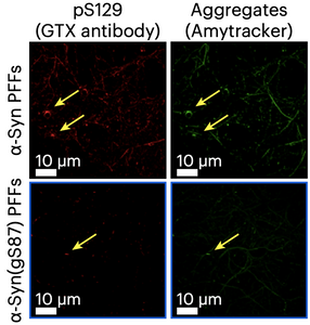 Glycosylation guides a safer strain of α-synuclein