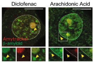 How functional amyloids help regulate stress responses