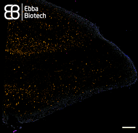 When proteins get out of shape
