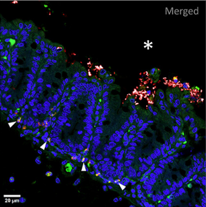 Bacterial Amyloids' Role in Autoimmune Inflammation