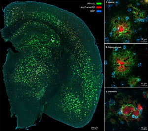 Antibodies Against a Synthetic Aβ Trimer-Mimic to Map Amyloid Pathology