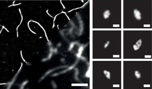 Linking aggregate size and toxicity using Amytracker