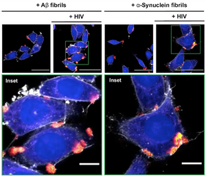 When Amyloids Meet Viruses: α-Synuclein Fibrils Enhance HIV-1 Infection