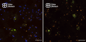 Amytracker and the age-pigment Lipofuscin