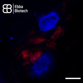 Deciphering the complexity of intracellular Tau aggregates