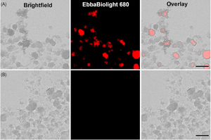 Biofilm formation of UPEC in a biomimetic device occurs at a late stage of colonisation