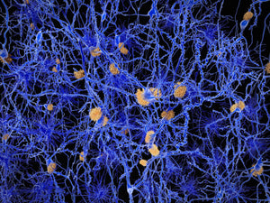 Amytracker can be used for intracerebral multiphoton microscopy