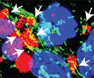 Amytracker shows how α-Synuclein aggregates at the mitochondrial membrane