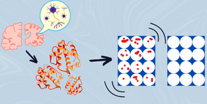 Finding the Invisible: How Amyloid Detection Is Improving