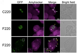 Unmasking the role of TDP-43 fragments in toxic aggregation