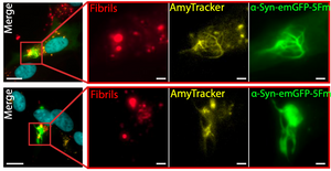 Phase separated α-synuclein is more prone to aggregation