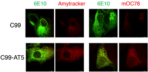 Faulty ribosome quality control triggers amyloid aggregation