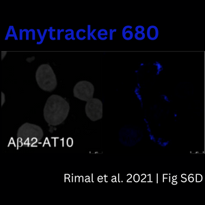 Exciting Discovery in Alzheimer’s Research!