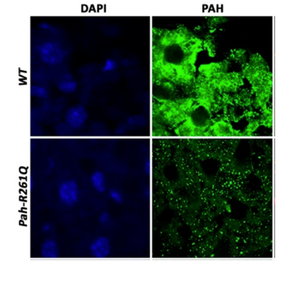 New Amytracker publication about protein aggregation in PKU