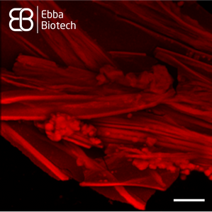Studying Spider Silk using Amytracker